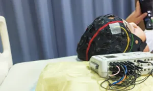 Dấu hiệu nào cho thấy trẻ bị mộng du?